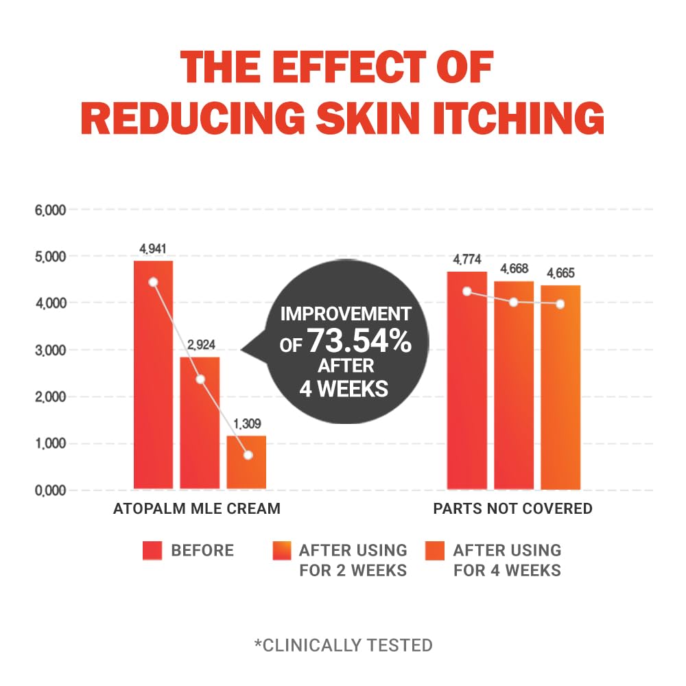 ATOPALM | MLE Eczema Cream | Premium Baby Face Cream | Body Moisturizer for Skin Barrier | Baby Lotion for Relieving Itchiness & Redness | Baby Eczema Cream for Sensitive Skin | 5.6 fl oz (165ml)